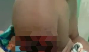 Lengan Kanan Putus, Begini Kronologi Arjo Warga Desa Delas Diterkam Buaya