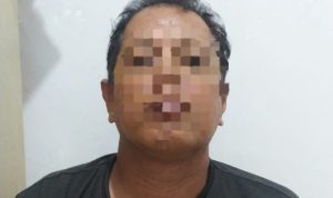 Menolak Dicerai, Suami Siram Istri Pakai Air Keras di Toboali